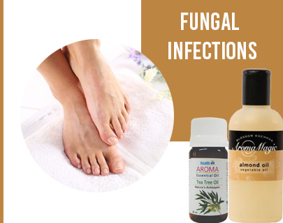 Summer Skin Care Tips- Fungal Infections
