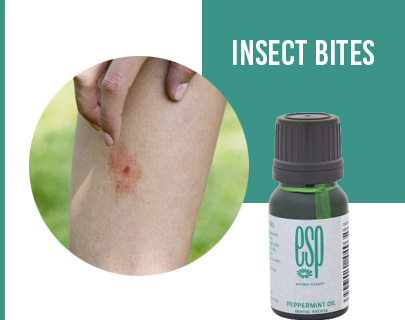 Summer Skin Care Tips- Insect Bites