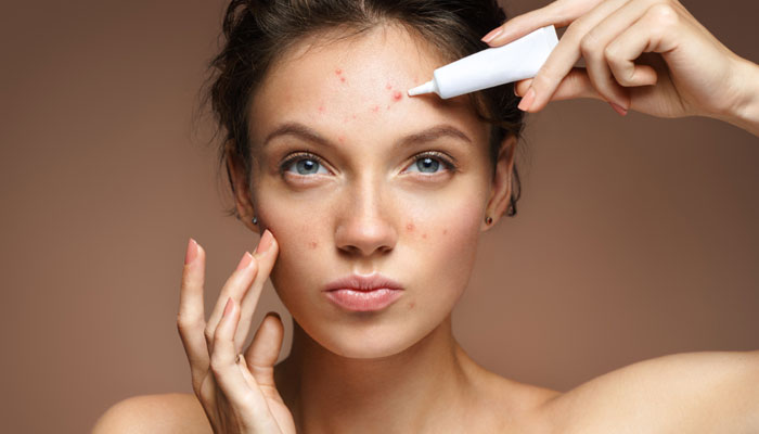 acne skin care