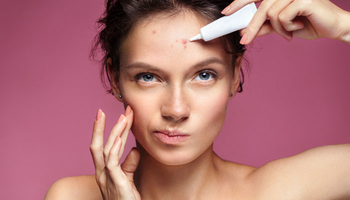 what causes pimples