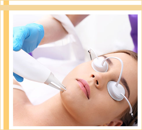 best acne treatments- laser treatment