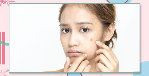 Reasons For Dull Skin – Hormonal Changes