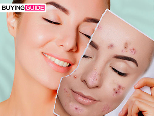 Stressed Skin Solutions Guide