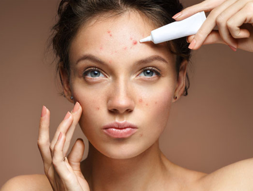 The Best Skincare Routine For Acne-Prone Skin