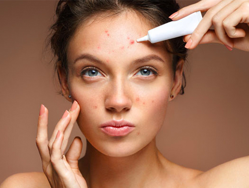 The Best Skincare Routine For Acne-Prone Skin