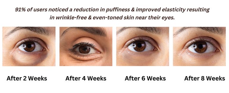 Be Bodywise 2% Bio Retinol Under Eye Cream - Helps Reduce Dark Circles, Fine Lines ,Wrinkles: Buy Be Bodywise 2% Bio Retinol Under Eye Cream - Reduce Dark Circles, Fine Lines ,
