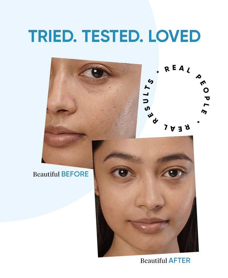 Sensitive skin, Moisturizing, Hydrating